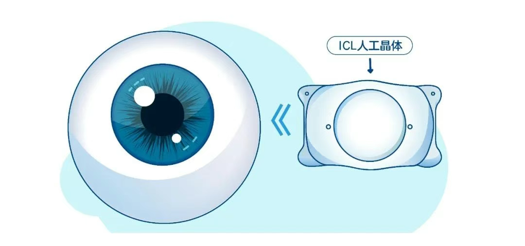 圖片.png 圖片.png