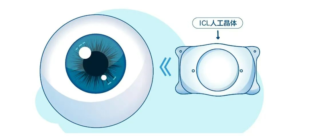 圖片.png 圖片.png